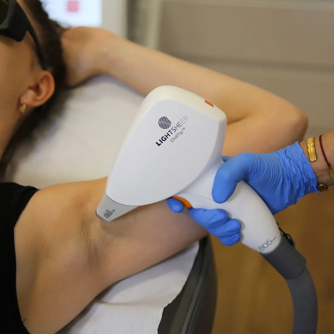 Laser Lumenis do depilacji laserowej w Płocku