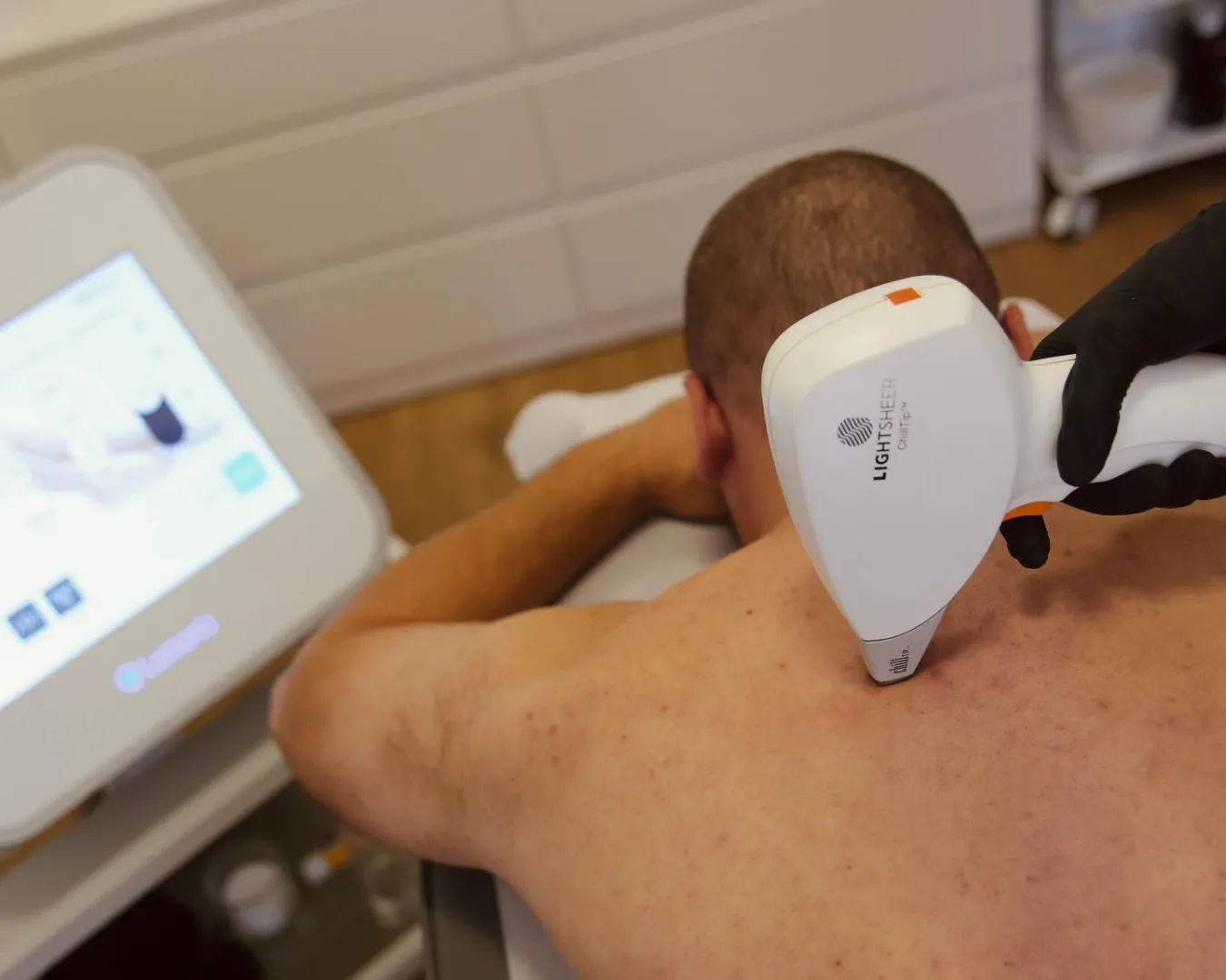 Epilacja laserowa bikini - efekty zabiegu Płock